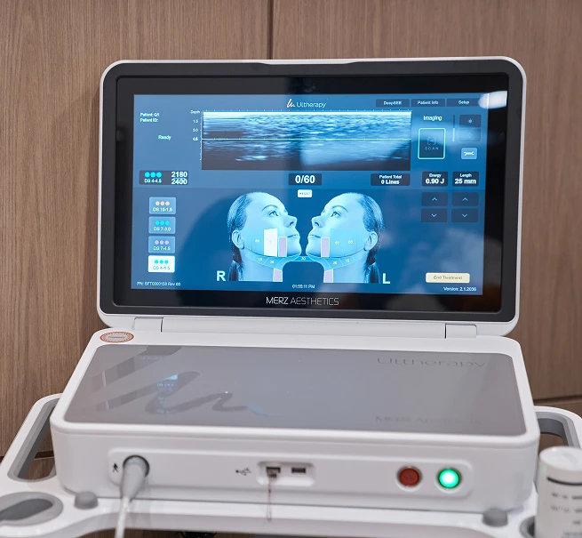 Ultherapy PRIME Treatment 3