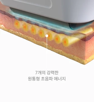 SUPERB™ Parallel Ultrasound