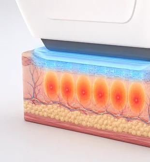 Sofcool™ Cooling System