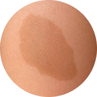 Pigmentation Image 1