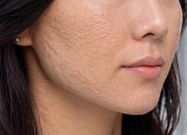Scars Image 1