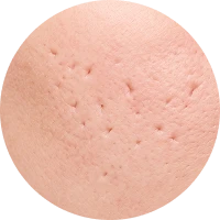 Scar Image 1