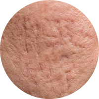 Scar Image 3