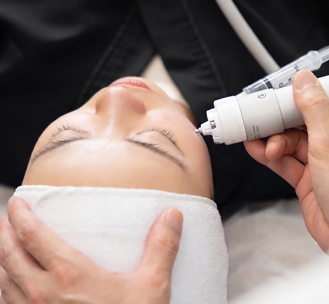 Scar Treatment 3